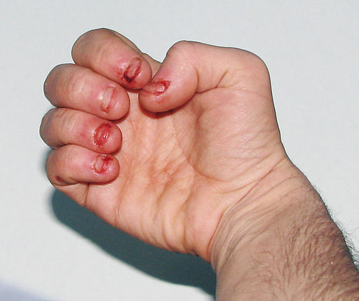 5 Things Only Someone With OCD Will Understand 5 Things Only Someone With OCD Will Understand